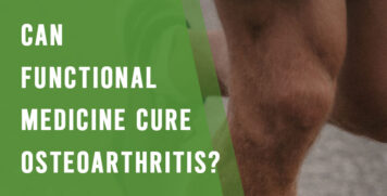 Can Functional Medicine Cure Osteoarthritis