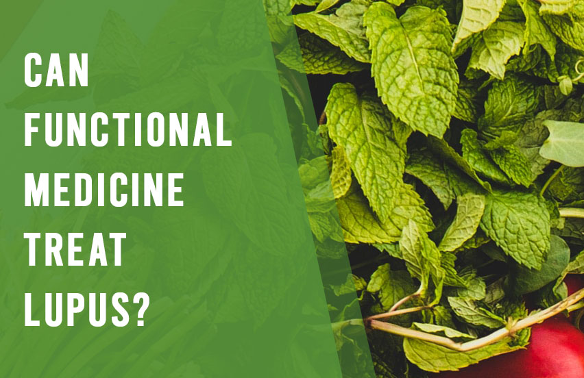 Can Functional Medicine Treat Lupus