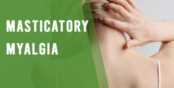 Masticatory Myalgia