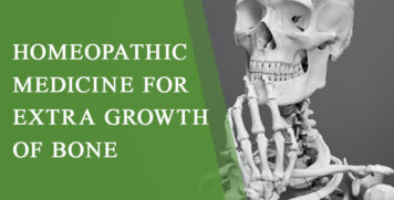 Homeopathic Medicine for Extra Growth of Bone