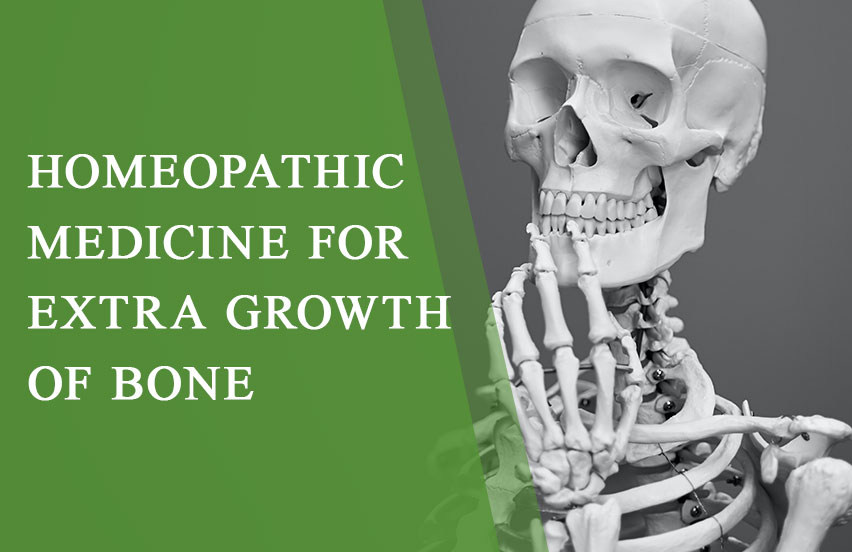 Homeopathic Medicine for Extra Growth of Bone