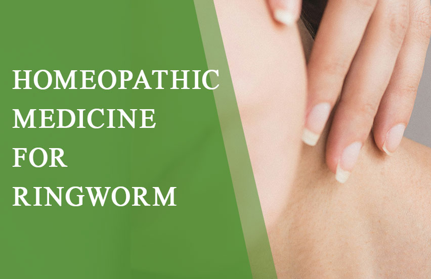 Homeopathic Medicine for Ringworm