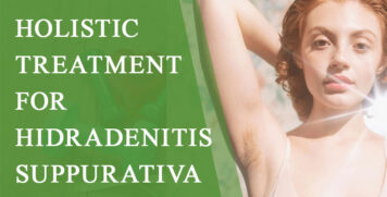 Holistic Treatment for Hidradenitis Suppurativa