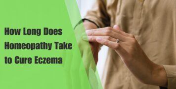 How Long Does Homeopathy Take to Cure Eczema