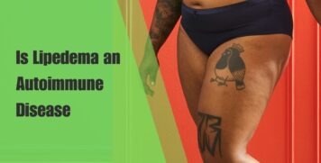 Is Lipedema an Autoimmune Disease