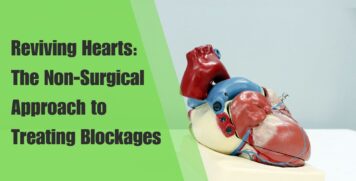 Reviving Hearts: The Non-Surgical Approach to Treating Blockages