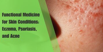 Functional Medicine for Skin Conditions Eczema, Psoriasis, and Acne