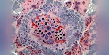 High-resolution histological stain image depicting inflamed cellular structures for medical diagnosis.
